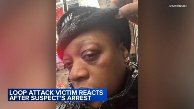 Alleged serial Loop puncher ordered detained after several attacks, some while wearing ankle monitor Alleged serial Loop puncher ordered detained after several attacks, some while wearing ankle monitor