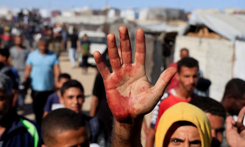 Gaza aid distribution declared ‘orchestrated killing’ by MSF Gaza aid distribution declared ‘orchestrated killing’ by MSF