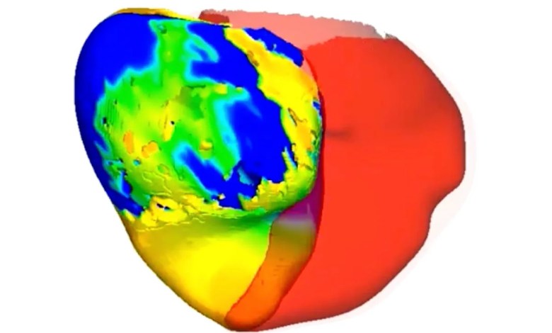To fix a patient’s irregular heartbeat, doctors first tested its digital ‘twin’ To fix a patient’s irregular heartbeat, doctors first tested its digital ‘twin’