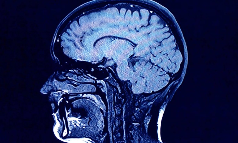 Human brains have 5 distinct ‘epochs’ in a lifetime, study finds Human brains have 5 distinct ‘epochs’ in a lifetime, study finds