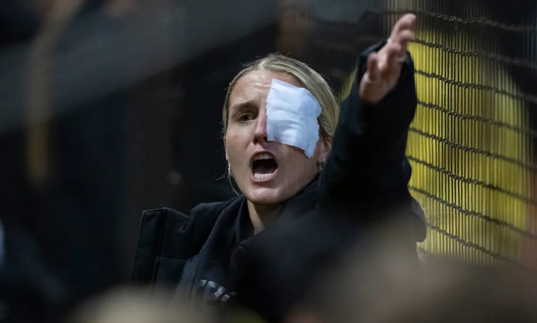 Oregon softball’s Lyndsey Grein out with an eye injury; what we know Oregon softball’s Lyndsey Grein out with an eye injury; what we know