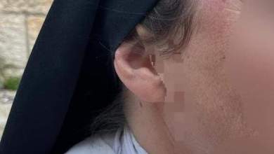 Attack on nun in Jerusalem sparks widespread condemnation Attack on nun in Jerusalem sparks widespread condemnation
