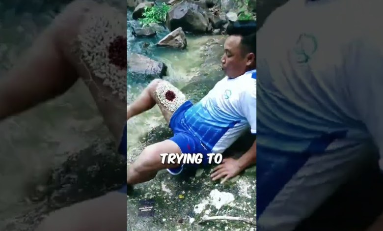 Viral Trypophobia Trend on Tik Tok Ticks Viral Trypophobia Trend on Tik Tok Ticks