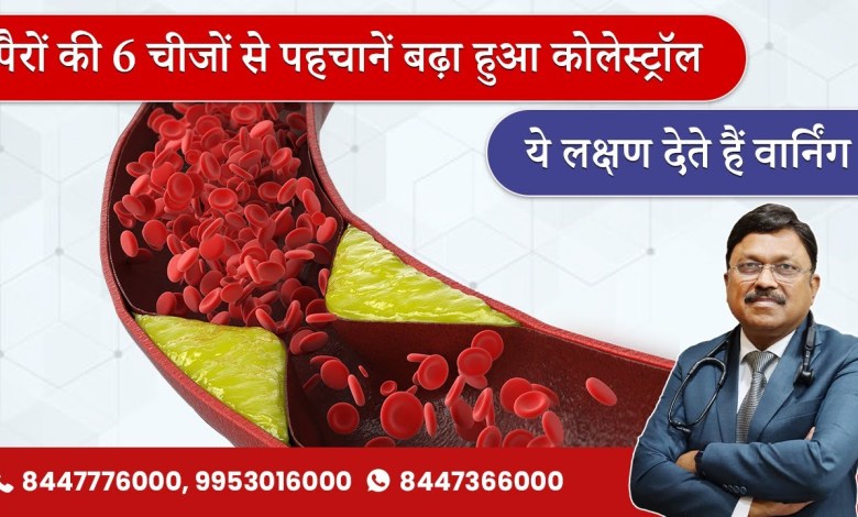 पैरों की 6 चीजों से पहचानें बढ़ा हुआ कोलेस्ट्रॉल | High Cholesterol – Symptoms & Causes | SAAOL पैरों की 6 चीजों से पहचानें बढ़ा हुआ कोलेस्ट्रॉल | High Cholesterol – Symptoms & Causes | SAAOL