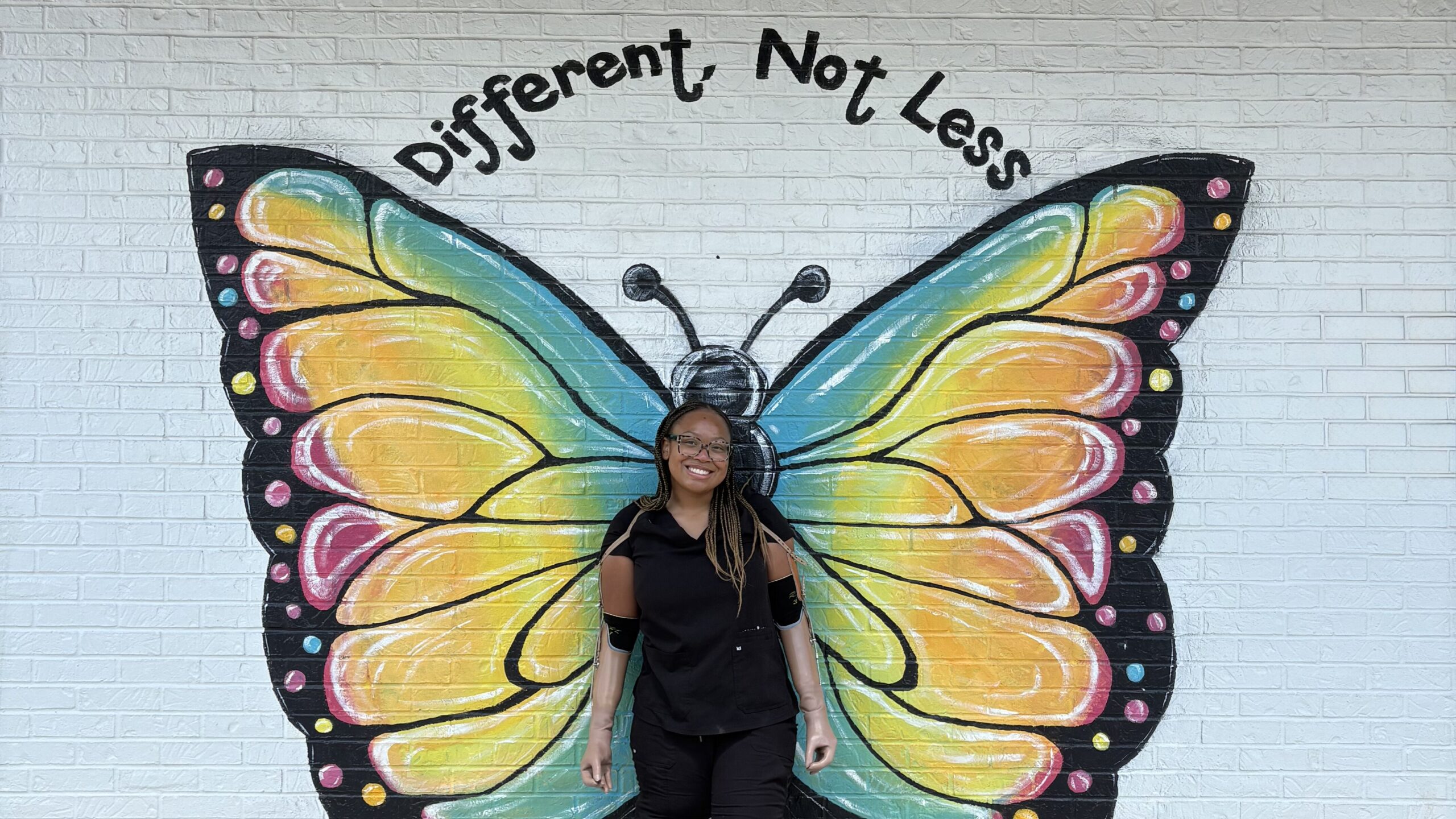 How this local quadruple amputee is bouncing back How this local quadruple amputee is bouncing back