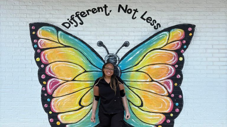 How this local quadruple amputee is bouncing back How this local quadruple amputee is bouncing back