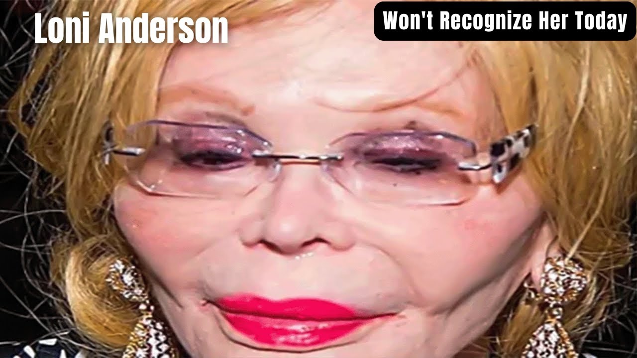 Is Loni Anderson Still Alive? The WKRP in Cincinnati Star’s Life, Career, and Legacy Today Is Loni Anderson Still Alive? The WKRP in Cincinnati Star’s Life, Career, and Legacy Today
