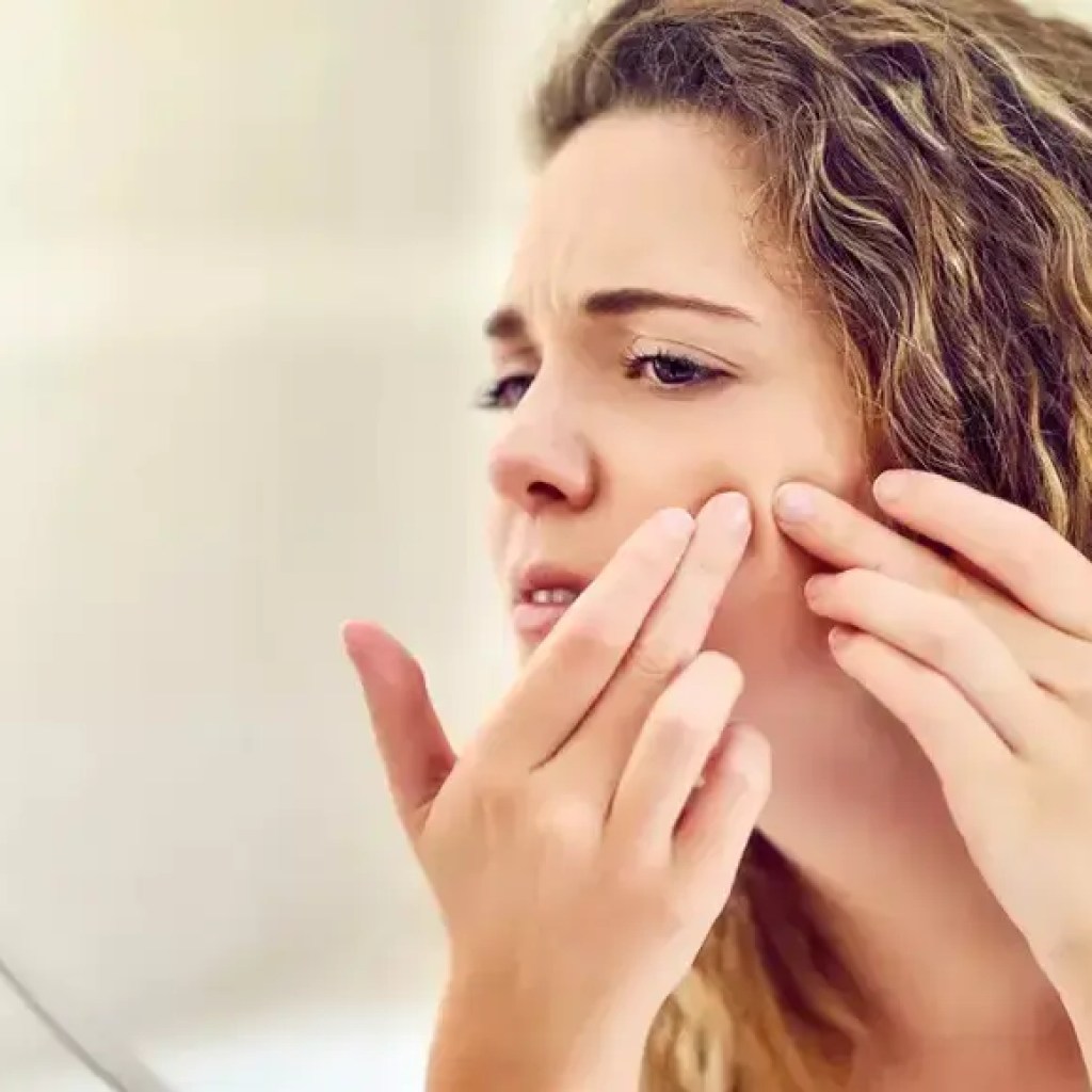 முகத்தின் இந்த பகுதியில் ஒரு பரு போப்பது உங்களை முடக்குகிறது, டாக் எச்சரிக்கிறார் | – தி டைம்ஸ் ஆஃப் இந்தியா முகத்தின் இந்த பகுதியில் ஒரு பரு போப்பது உங்களை முடக்குகிறது, டாக் எச்சரிக்கிறார் | – தி டைம்ஸ் ஆஃப் இந்தியா