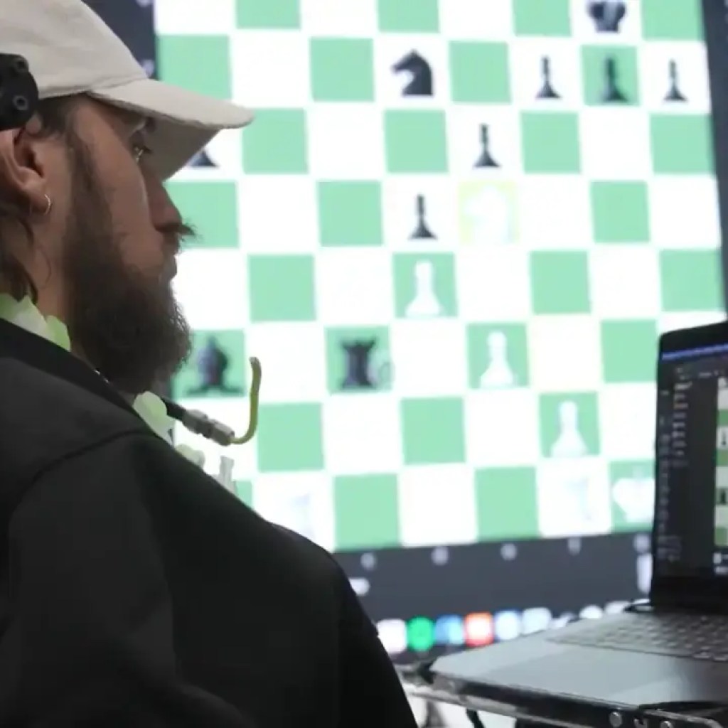 இது உண்மையாக இருக்கக்கூடாது: முடங்கிய நோயாளிகள் நியூராலிங்க் மாற்று அறுவை சிகிச்சைக்குப் பிறகு நினைத்துக்கொண்டு வீடியோ கேம்களை விளையாடுகிறார்கள் | – டைம்ஸ் ஆஃப் இந்தியா இது உண்மையாக இருக்கக்கூடாது: முடங்கிய நோயாளிகள் நியூராலிங்க் மாற்று அறுவை சிகிச்சைக்குப் பிறகு நினைத்துக்கொண்டு வீடியோ கேம்களை விளையாடுகிறார்கள் | – டைம்ஸ் ஆஃப் இந்தியா