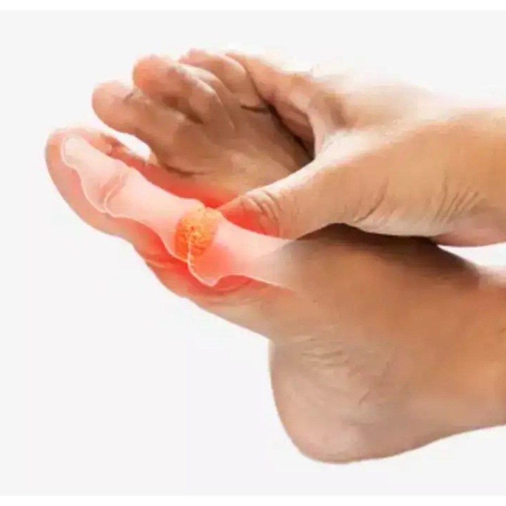 திடீர் மாரடைப்புகளுடன் இணைக்கப்பட்ட உயர் யூரிக் அமில நிலை: அதை வீழ்த்துவதற்கான 7 வழிகள் திடீர் மாரடைப்புகளுடன் இணைக்கப்பட்ட உயர் யூரிக் அமில நிலை: அதை வீழ்த்துவதற்கான 7 வழிகள்