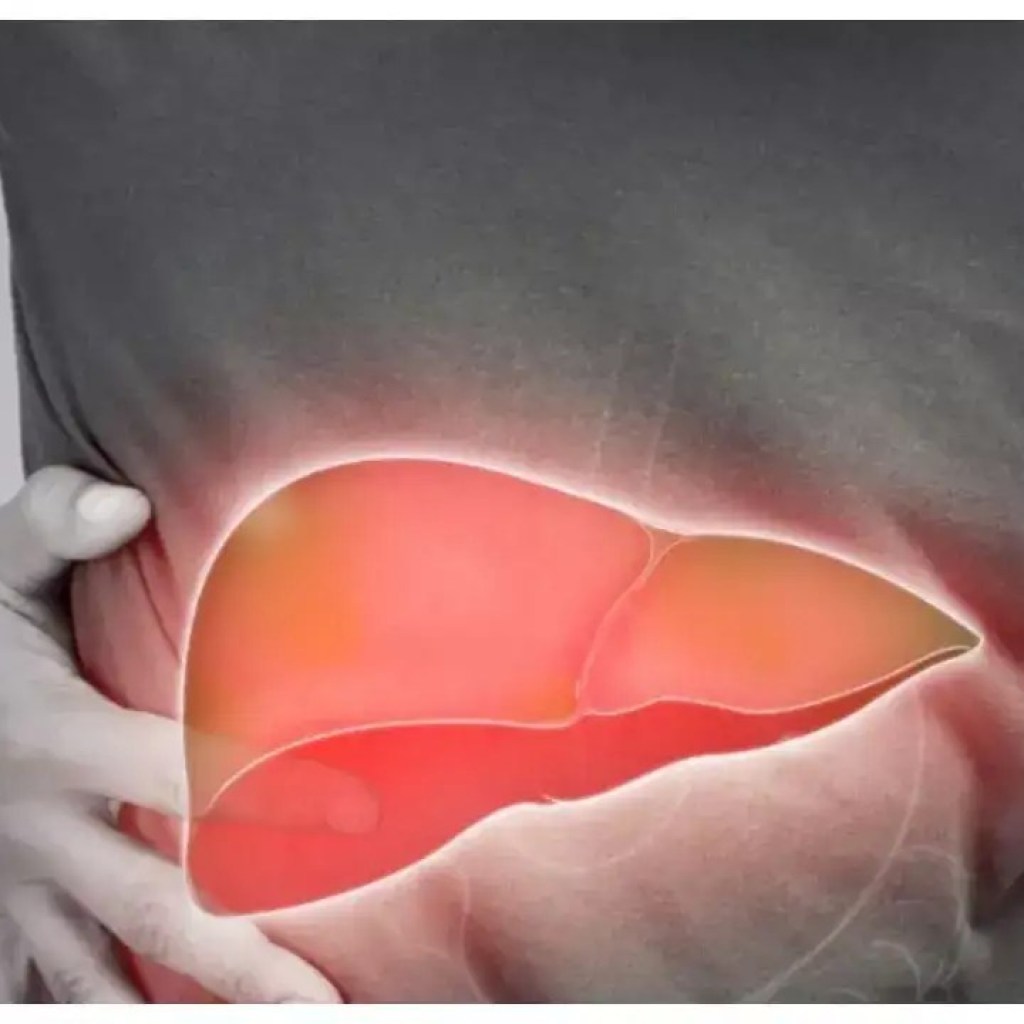 மஞ்சள் காமாலை காரணங்கள்: ஹெபடைடிஸ் ஒரு வழக்குகள் அதிகரித்து வருகின்றன: மஞ்சள் காமாலை நடப்பதற்கான 5 காரணங்கள் மற்றும் பாதுகாப்பாக இருப்பது எப்படி மஞ்சள் காமாலை காரணங்கள்: ஹெபடைடிஸ் ஒரு வழக்குகள் அதிகரித்து வருகின்றன: மஞ்சள் காமாலை நடப்பதற்கான 5 காரணங்கள் மற்றும் பாதுகாப்பாக இருப்பது எப்படி