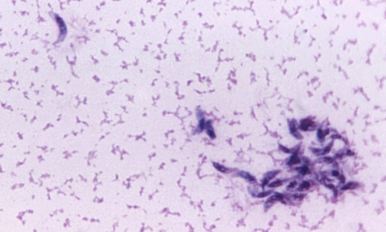 This cat’s poop parasite decapitates sperm – may fuel infertility This cat’s poop parasite decapitates sperm – may fuel infertility