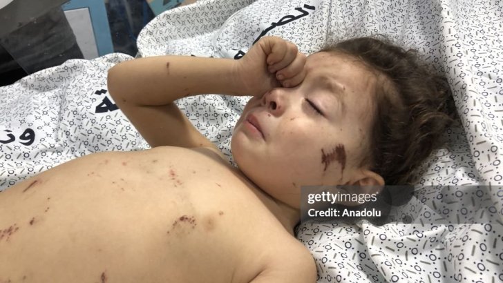 US medics: Gaza’s children are “maimed and mutilated by our weapons” – Day 292 US medics: Gaza’s children are “maimed and mutilated by our weapons” – Day 292