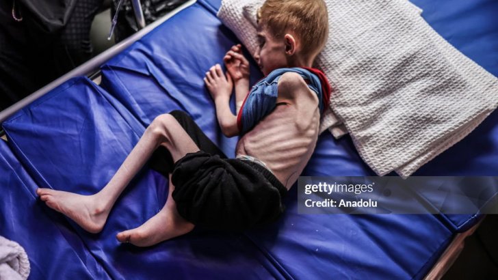 All of Gaza suffering under famine – Day 276 All of Gaza suffering under famine – Day 276