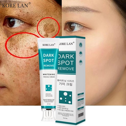 본토출하(당일발송) KORELAN 검버섯 황갈반 크림 미백크림 무자극 안전 성분, 20g, 2개