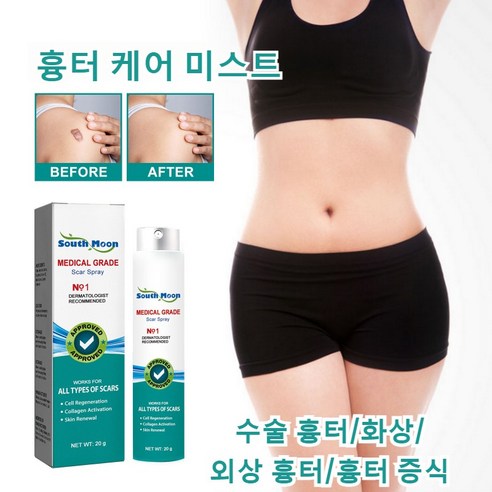 흉터 케어 미스트 수술흉터 화상물집 쌍꺼풀흉터 제왕절개흉터 흉터제거연고 재생크림 과민성 흉터/흉터 증식, 20g, 5개