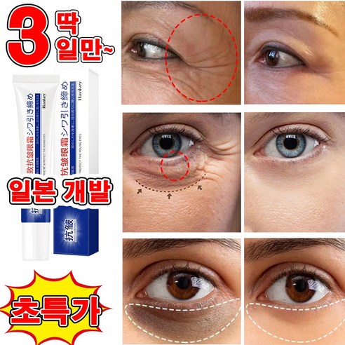 [일본 개발] 1+1/2+2 눈가주름개선 아이크림 눈밑주름 다크서클 비립종제거 아이백 미간 주름 콜라겐 리프팅 레티놀 텐션 크림, 4개, 20g