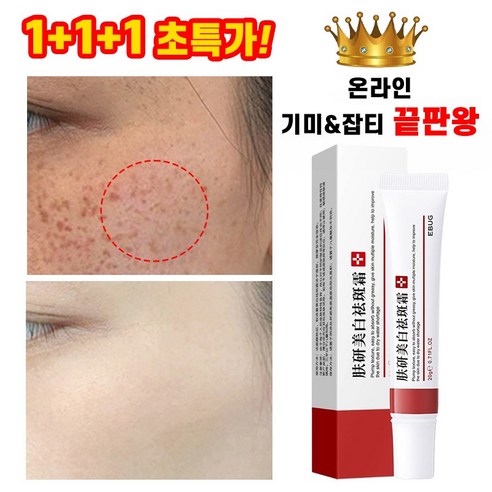 [당일배송] 1/1+1/1+1+1 기미크림 얼굴 기미잡티 제거크림 피부 색소침착 반점 주근깨 제거, 1+1개, 50ml