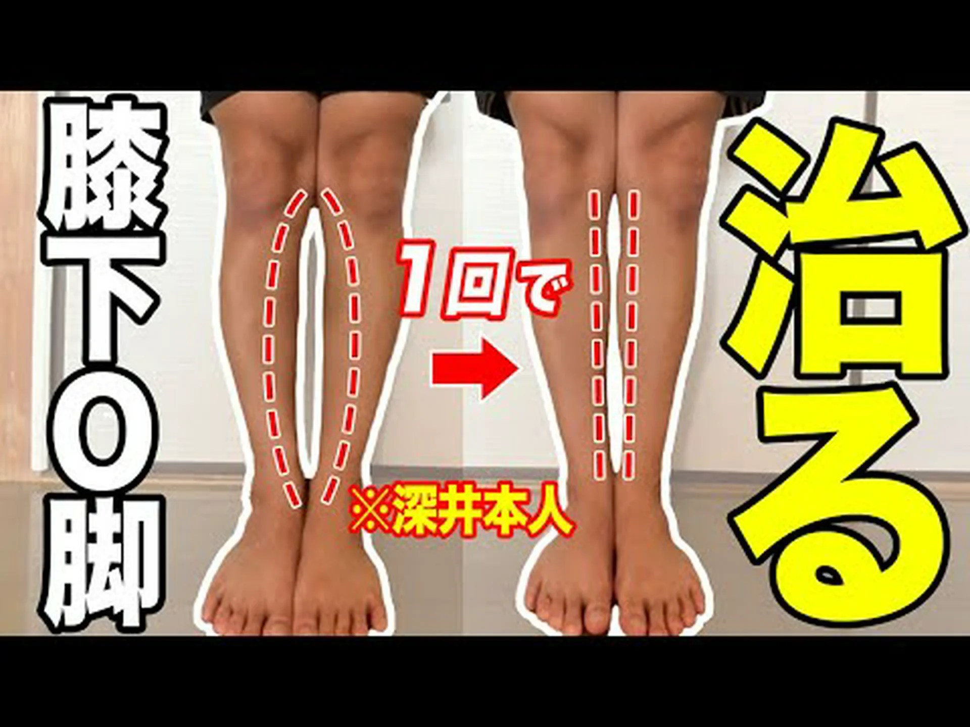 13歳でもサッカーでO脚になる 13歳でもサッカーでO脚になる