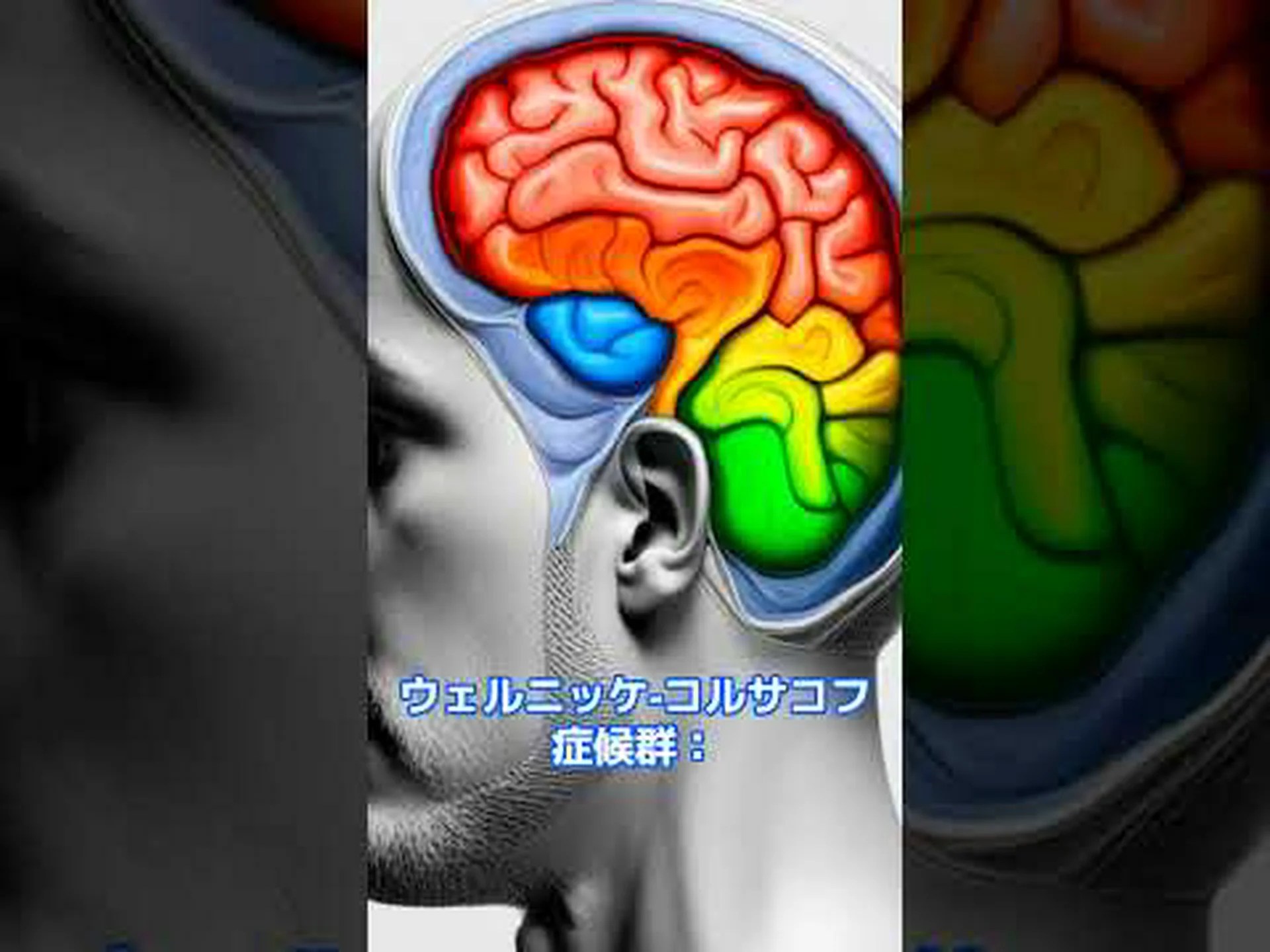 アルコール中毒は数日以内に脳にダメージを与える アルコール中毒は数日以内に脳にダメージを与える