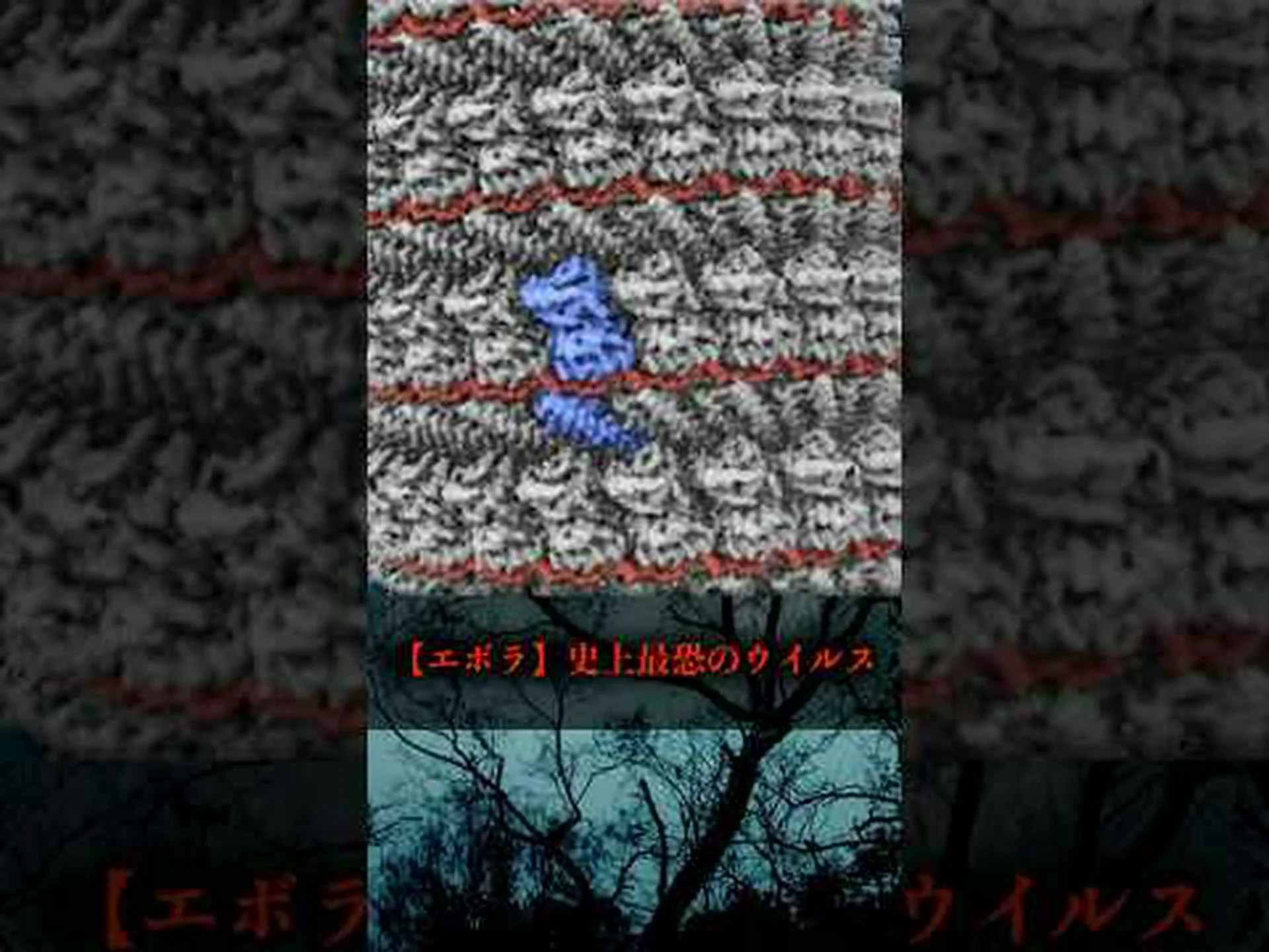 エボラ出血熱治療の進歩 エボラ出血熱治療の進歩