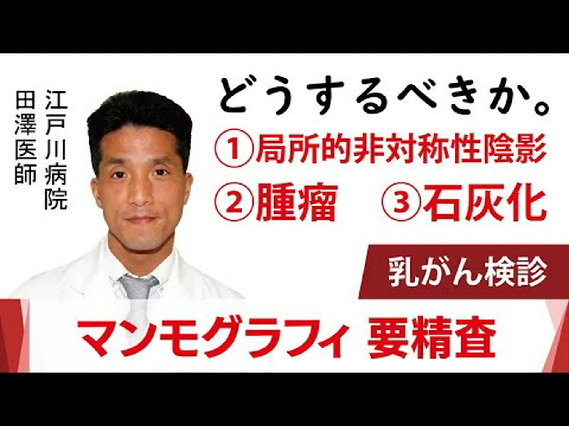 スウェーデンの長期研究でマンモグラフィーの有効性が証明 スウェーデンの長期研究でマンモグラフィーの有効性が証明