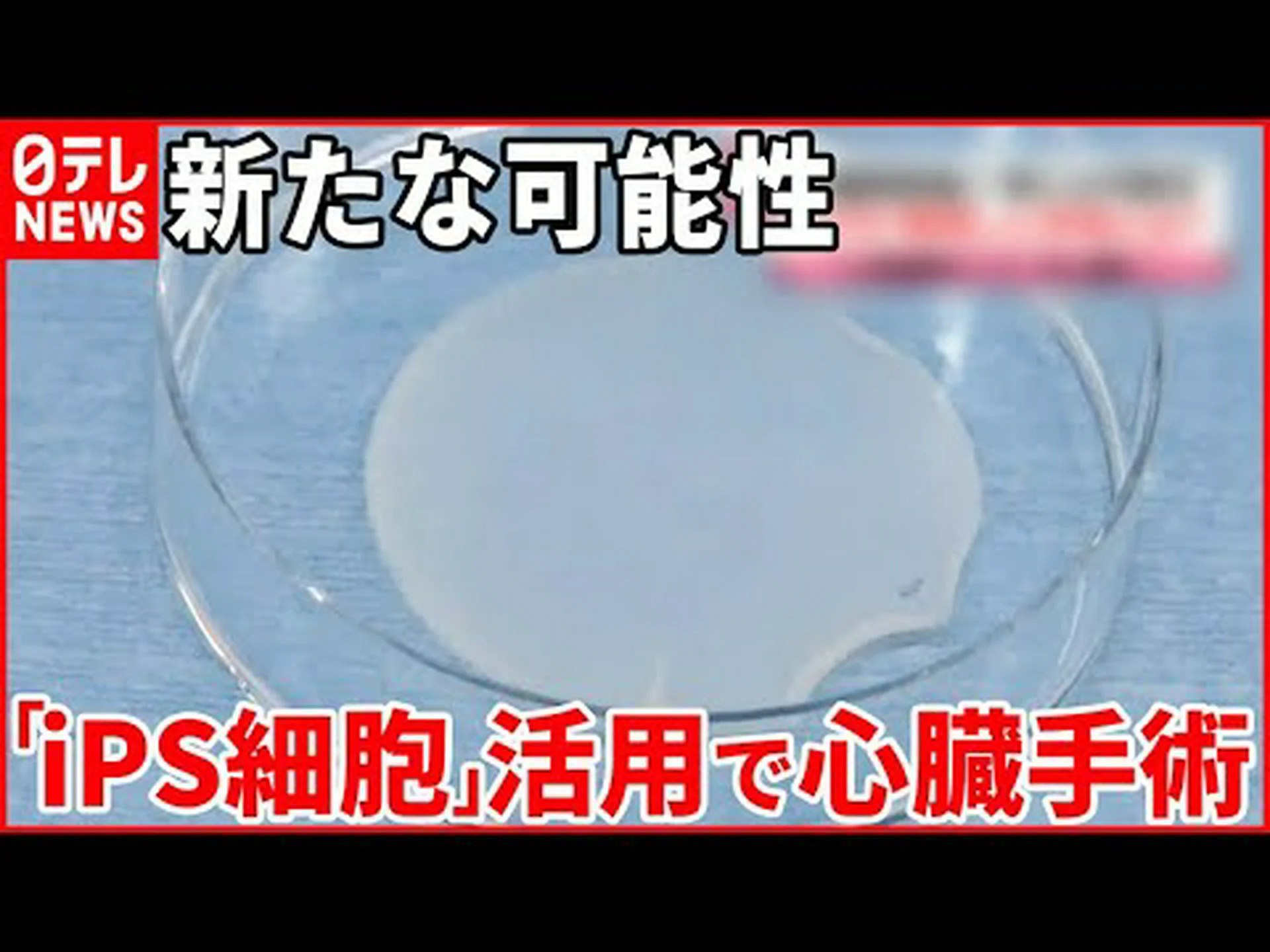 心臓発作後に心筋細胞が自己再生する 心臓発作後に心筋細胞が自己再生する