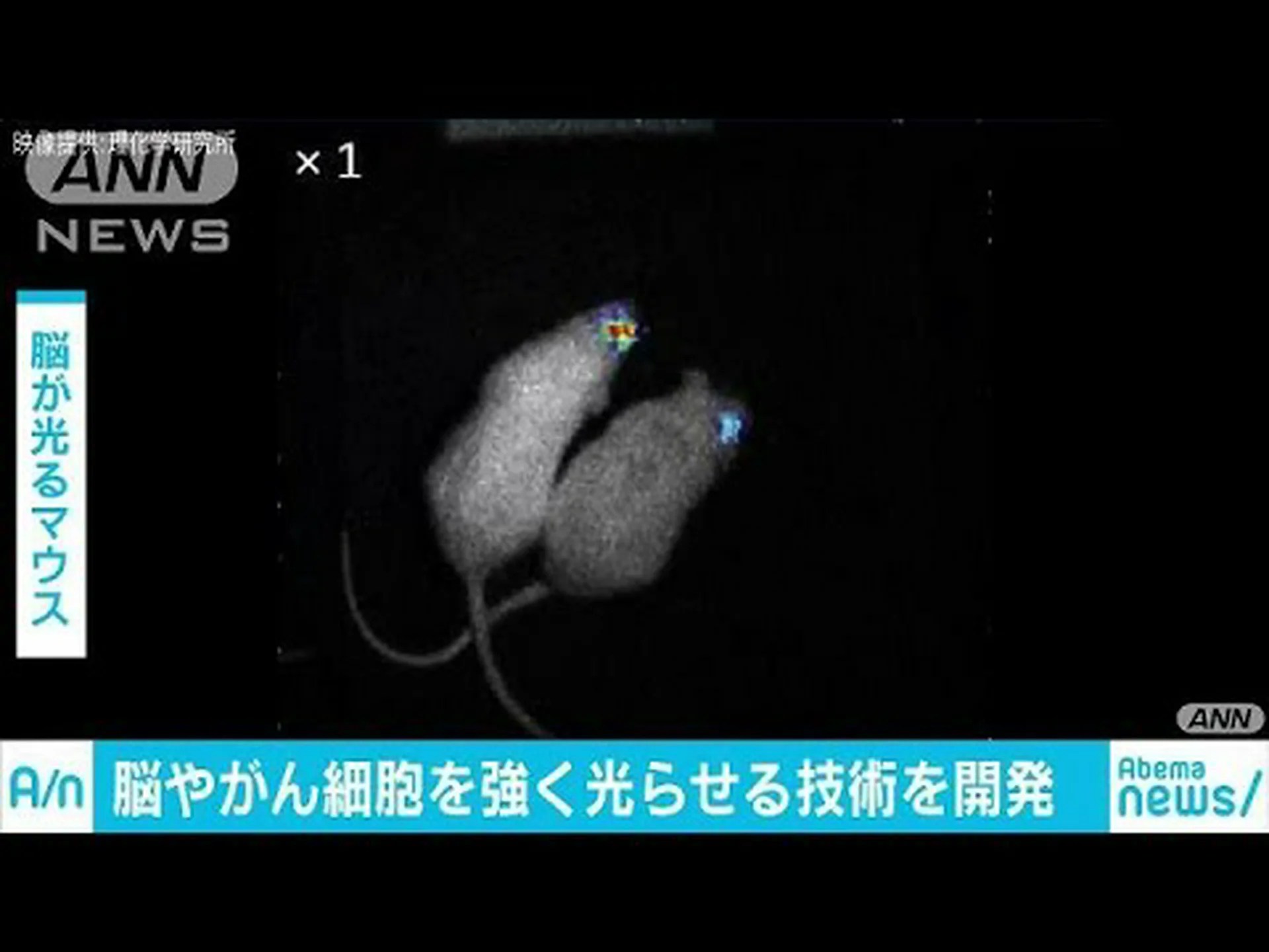 がん細胞のため渡航禁止 がん細胞のため渡航禁止