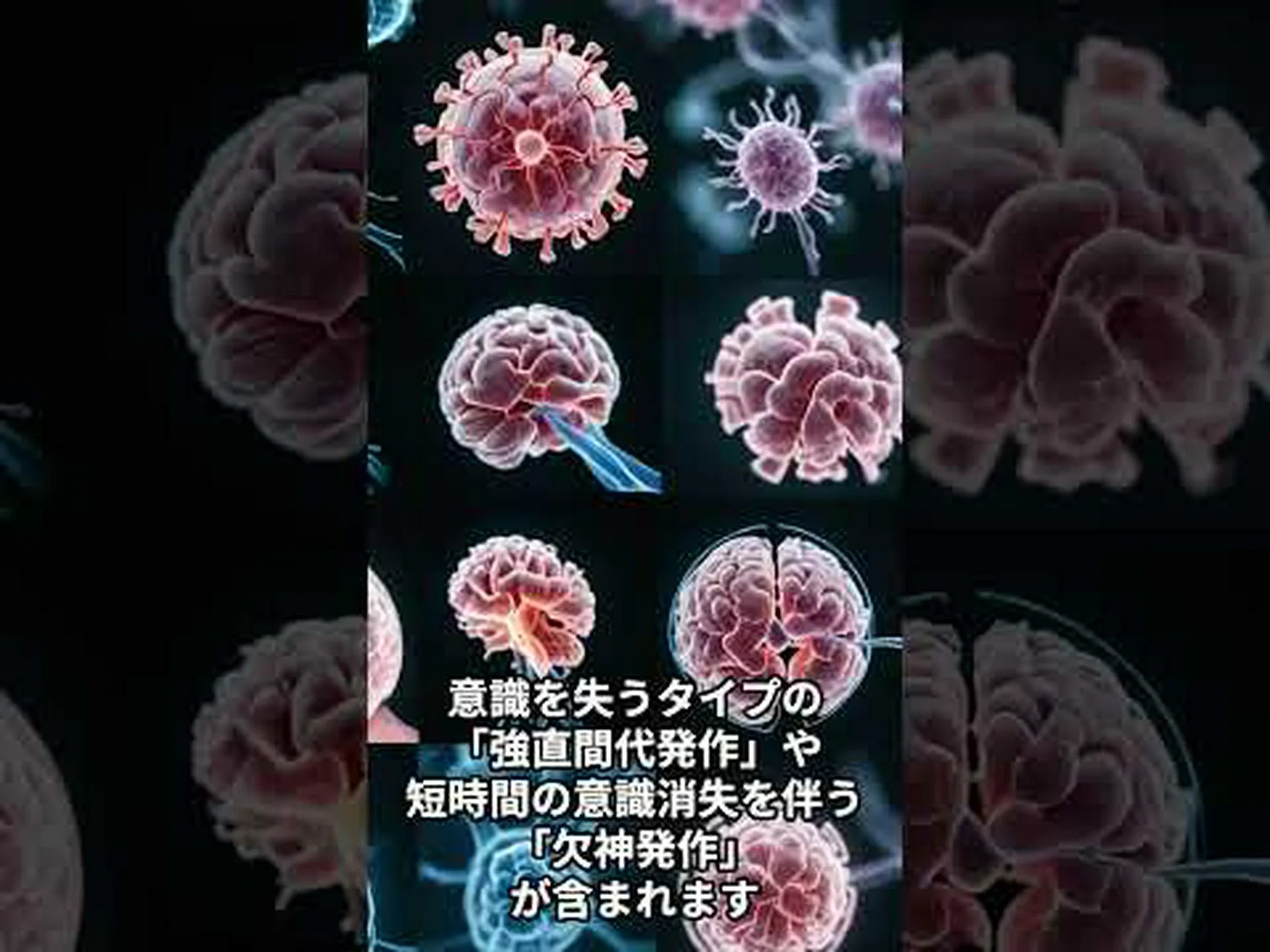 遺伝子変異が幻聴を伴うてんかんを引き起こす 遺伝子変異が幻聴を伴うてんかんを引き起こす