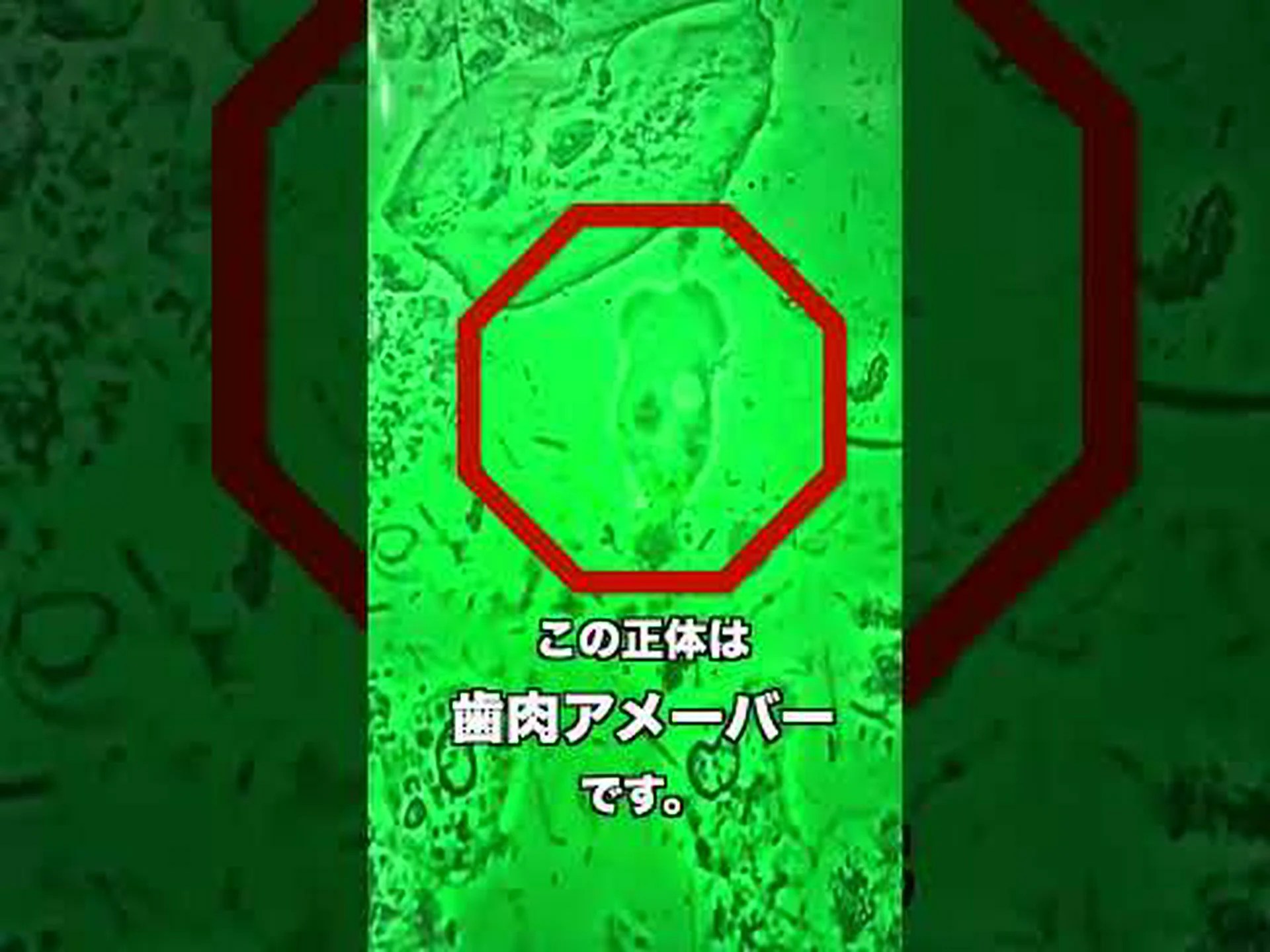 虫歯に対する微生物の咀嚼 虫歯に対する微生物の咀嚼