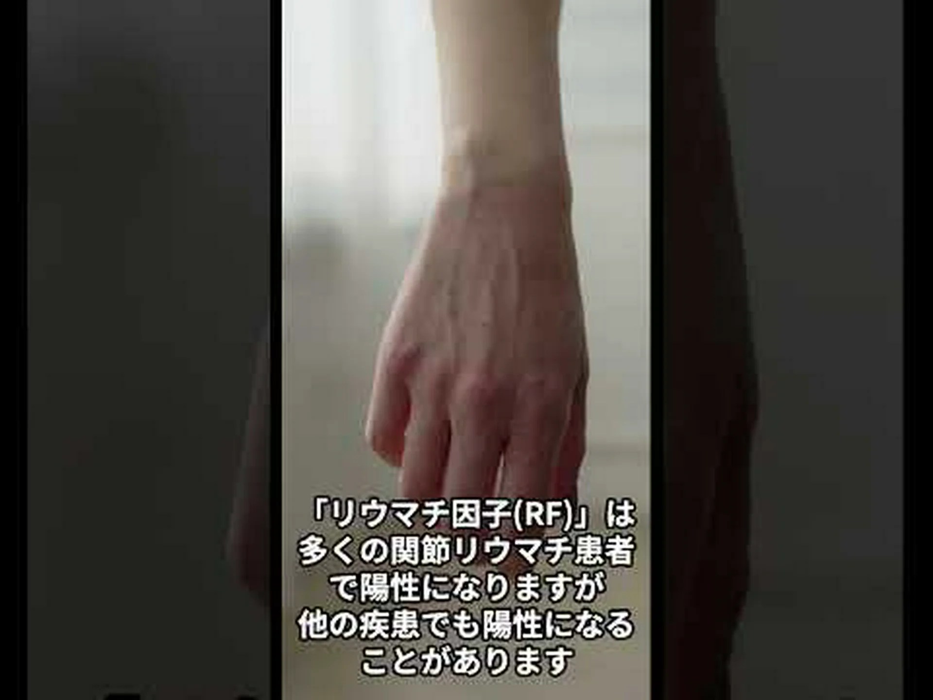 注目を集める抗体療法 注目を集める抗体療法