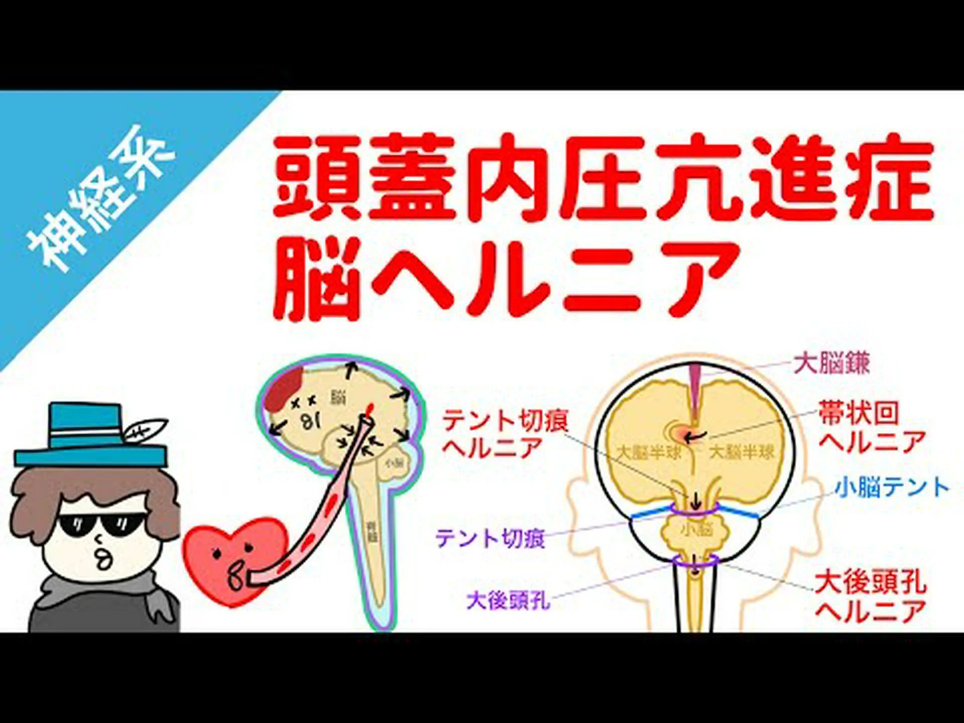 耳の頭蓋内圧 耳の頭蓋内圧