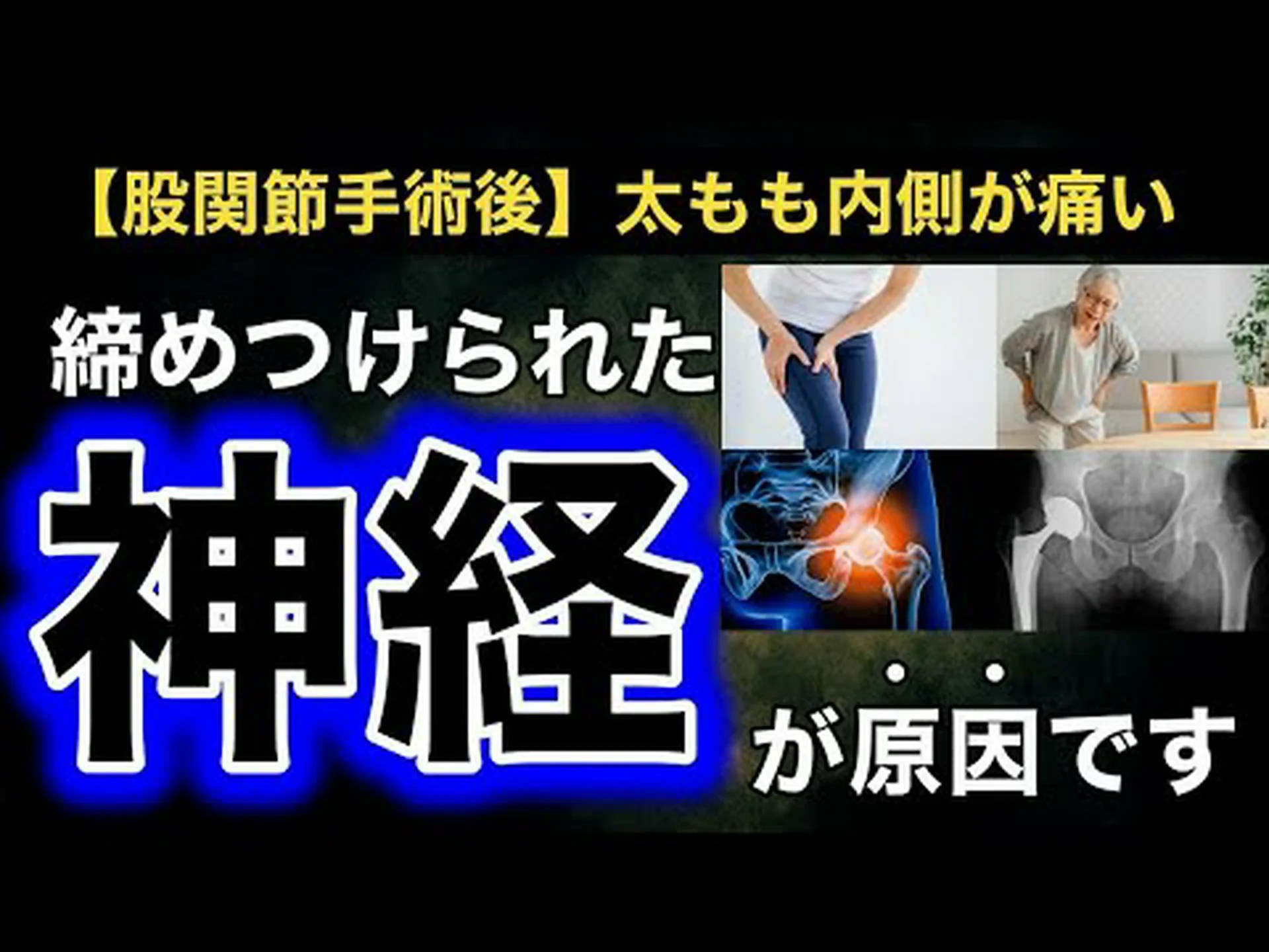 再建された大腿骨はそれに伴って成長します 再建された大腿骨はそれに伴って成長します