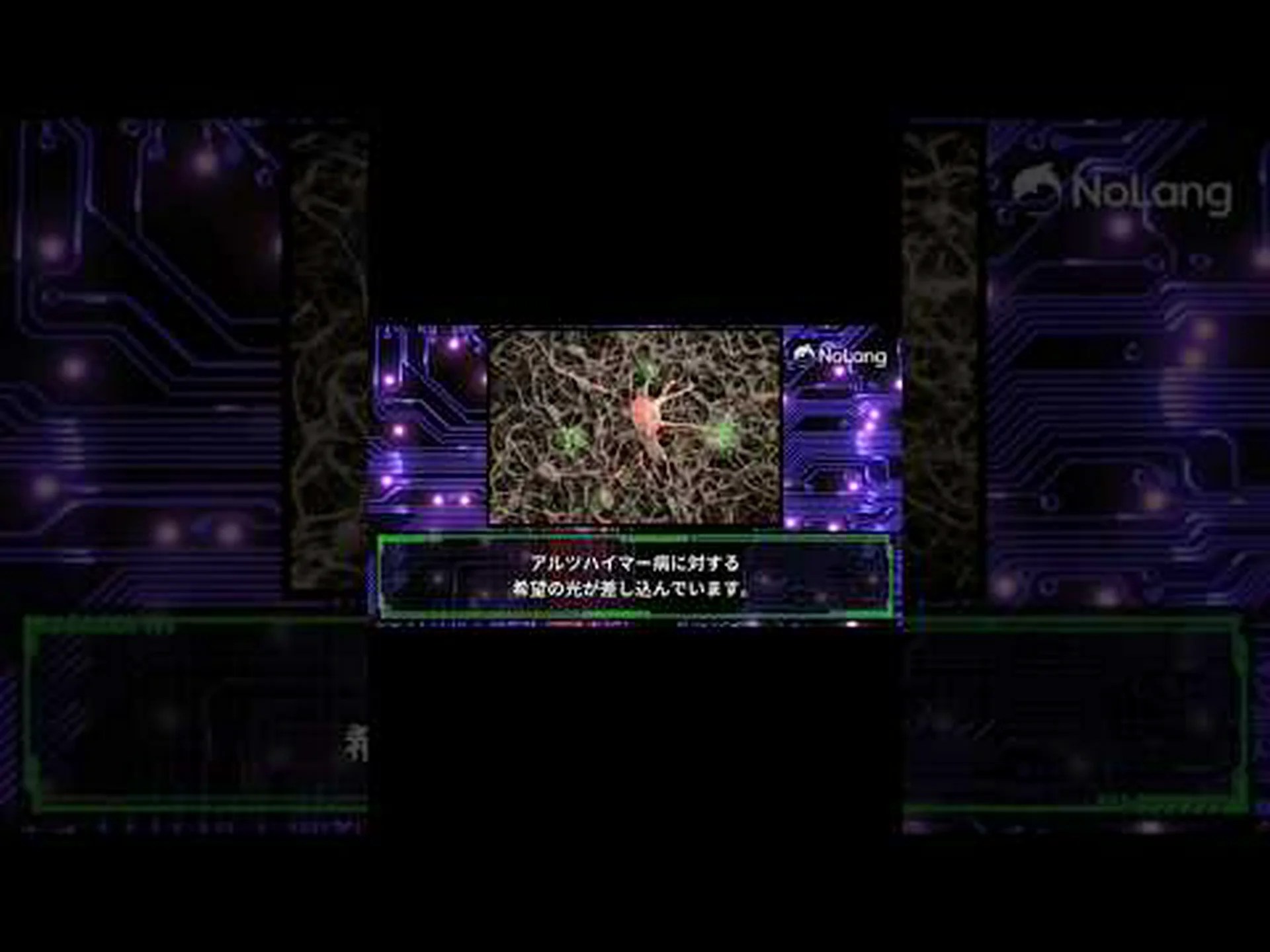 アルツハイマー病に対する絆創膏? アルツハイマー病に対する絆創膏?