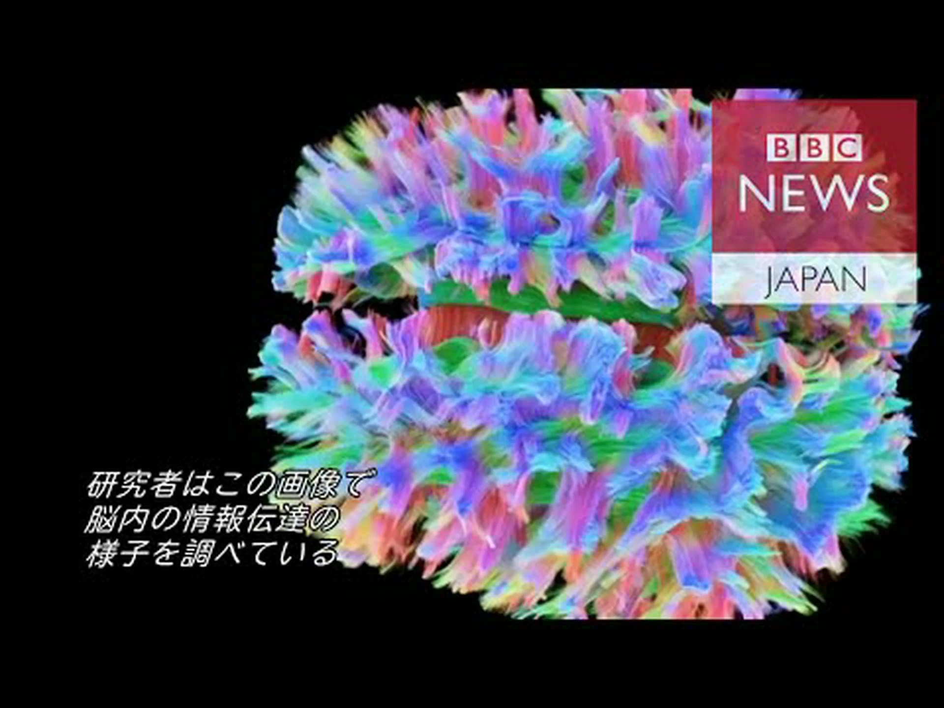 無駄な脳スキャン 無駄な脳スキャン