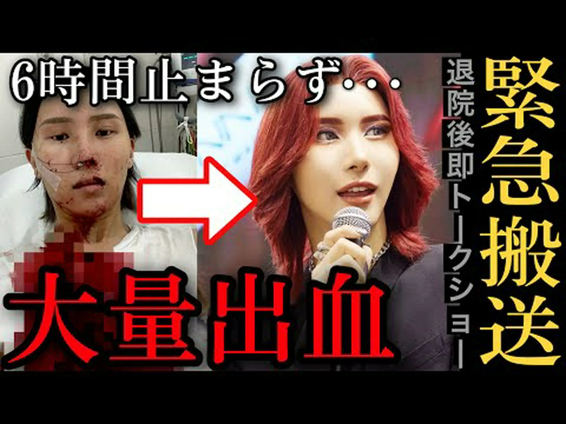 パウダーで出血が止まる パウダーで出血が止まる