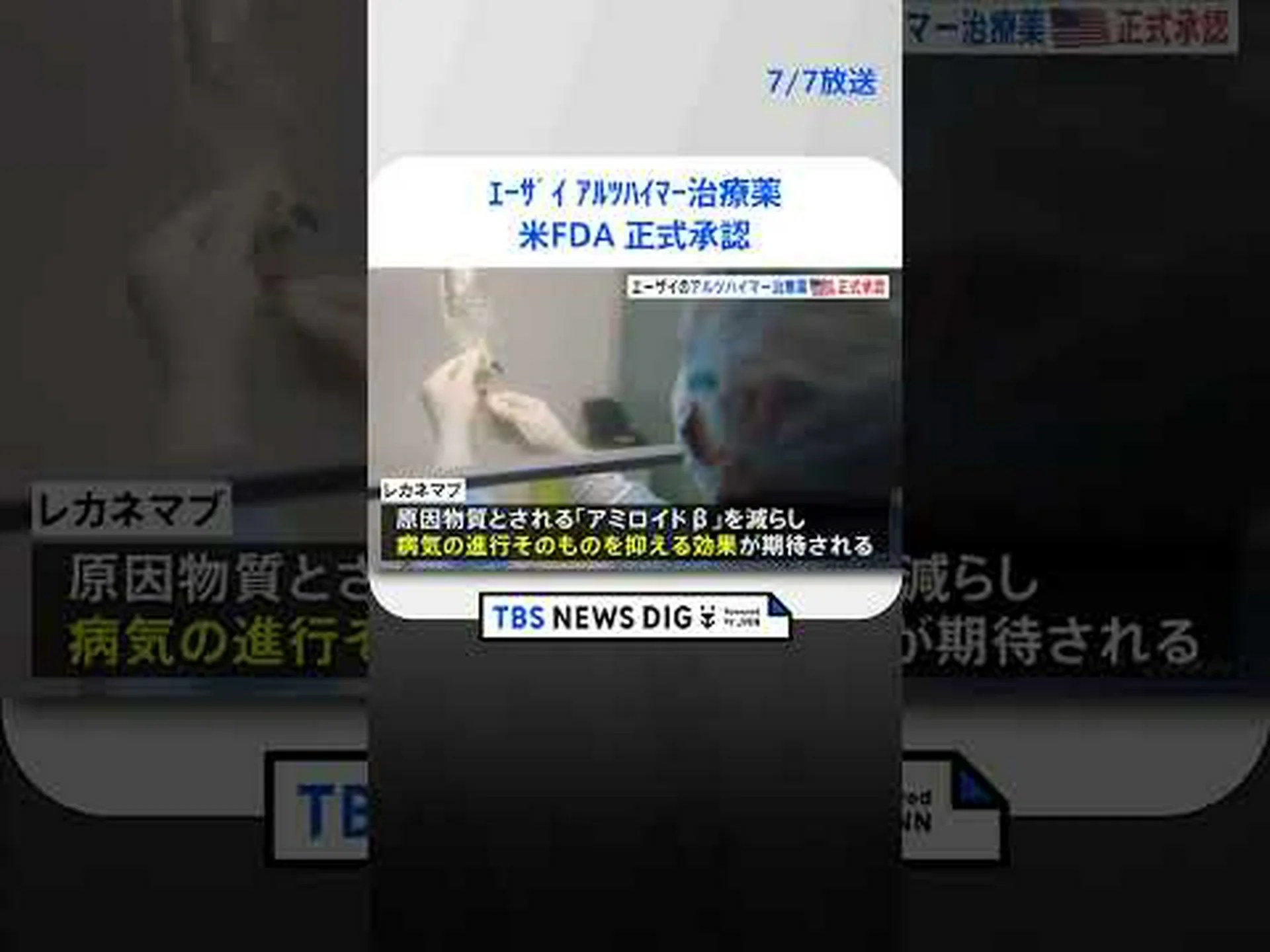 脳内のアルツハイマー病沈着物が溶解した 脳内のアルツハイマー病沈着物が溶解した