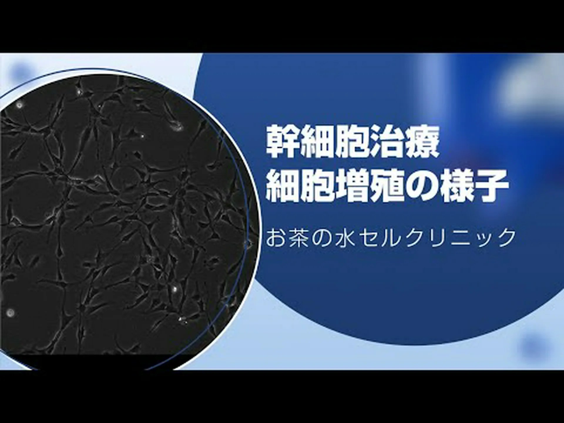 研究者らは、へその緒から採取した幹細胞を保存しないようアドバイスしている 研究者らは、へその緒から採取した幹細胞を保存しないようアドバイスしている