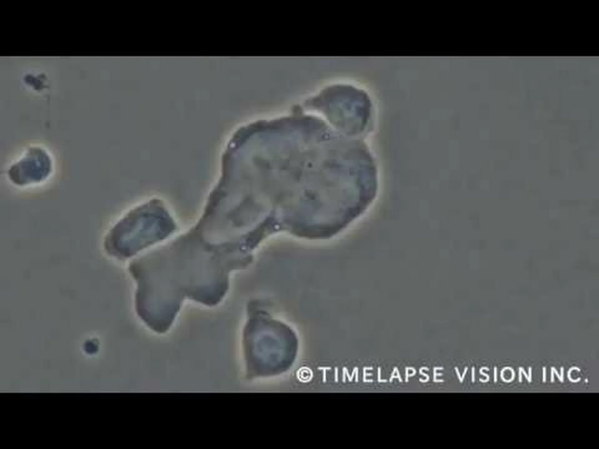 がんを殺す細菌としての細菌 がんを殺す細菌としての細菌