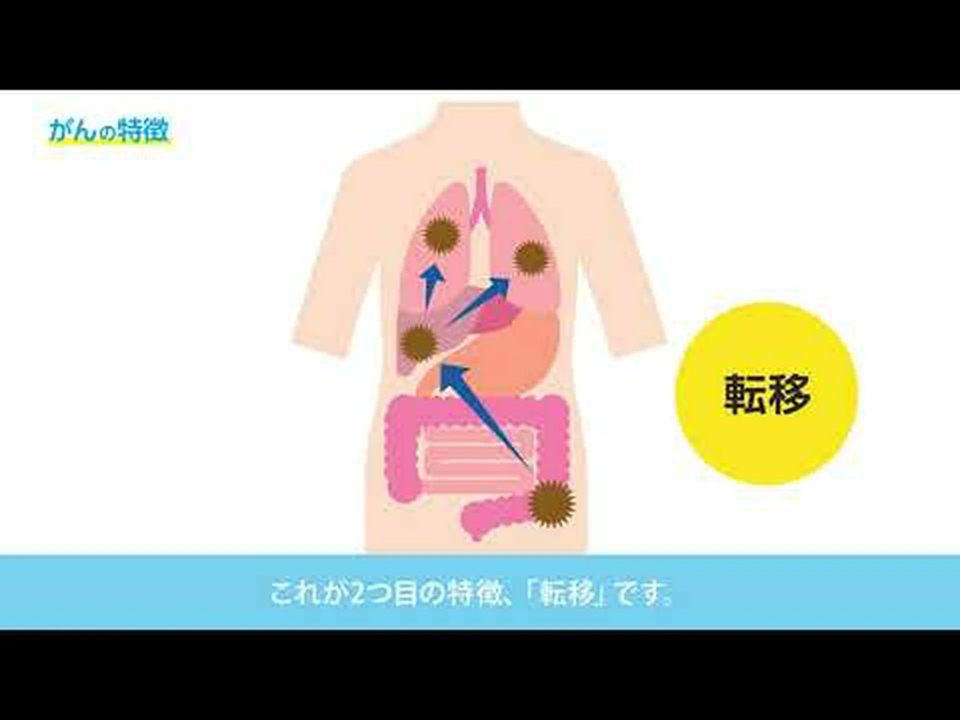 がんはどのように発生するのか がんはどのように発生するのか