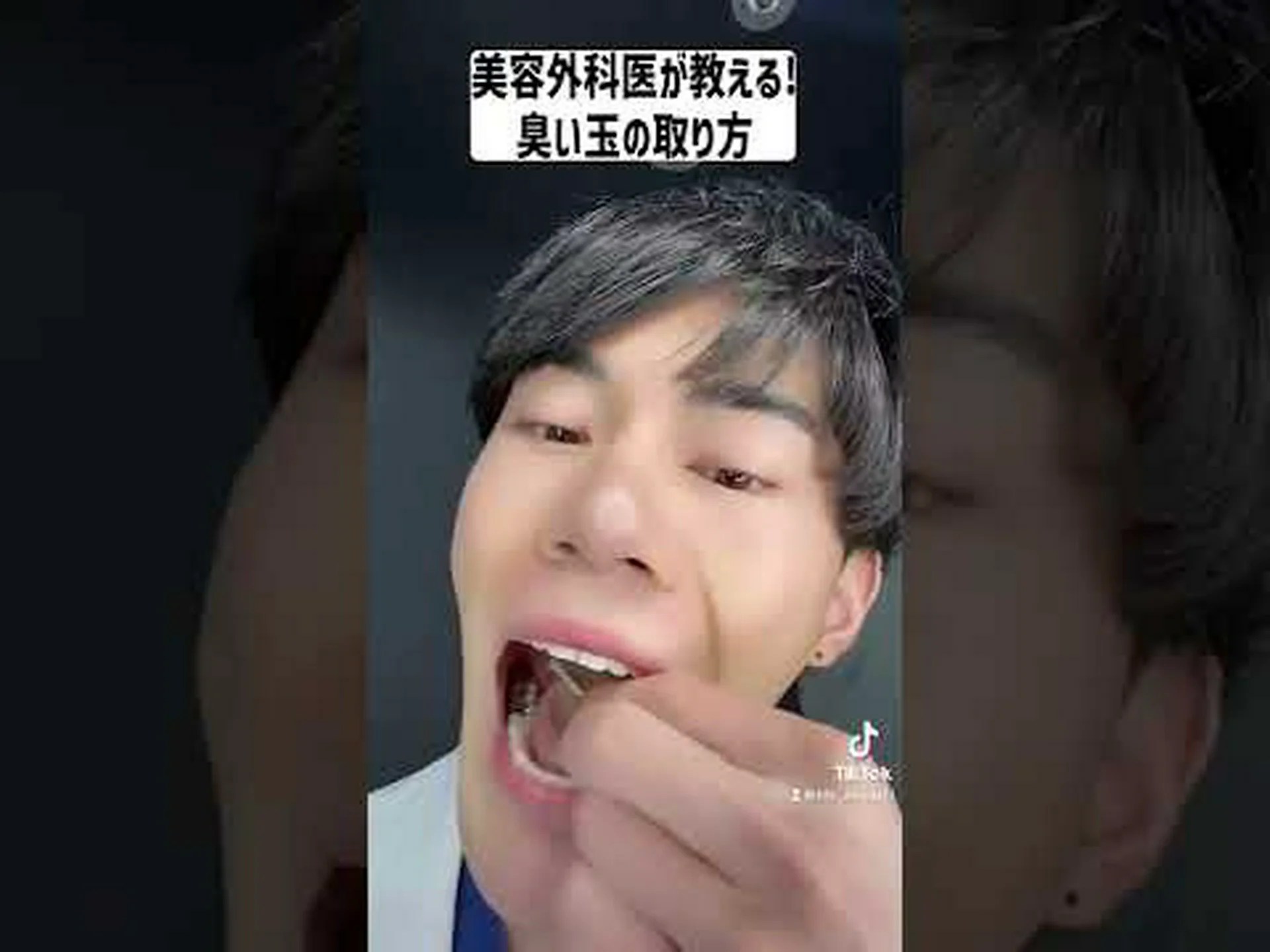 鳥:尻の分泌物の匂いは何のためにあるのか 鳥:尻の分泌物の匂いは何のためにあるのか