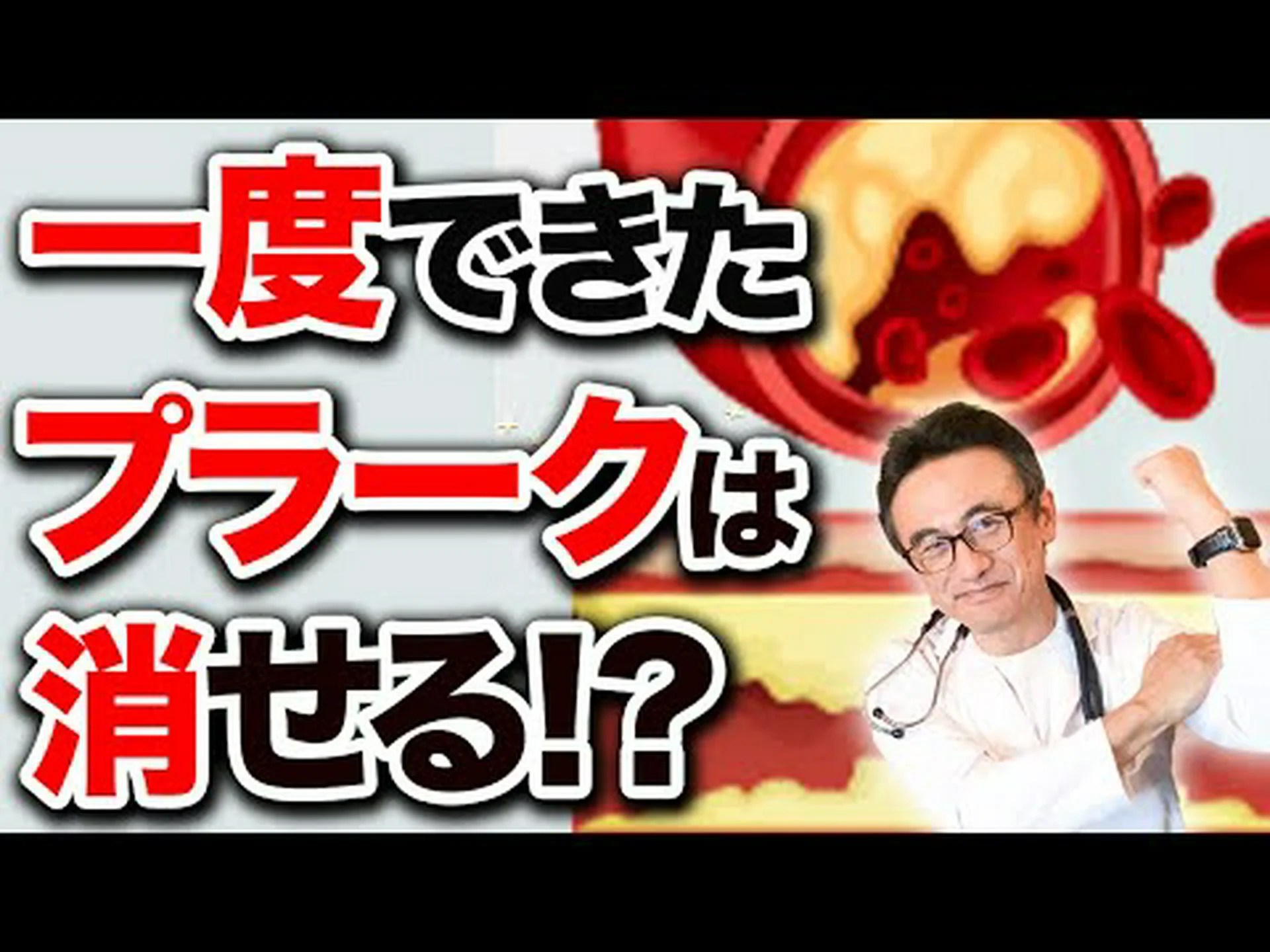 薬物の組み合わせにより、詰まった心臓動脈が解消されます 薬物の組み合わせにより、詰まった心臓動脈が解消されます