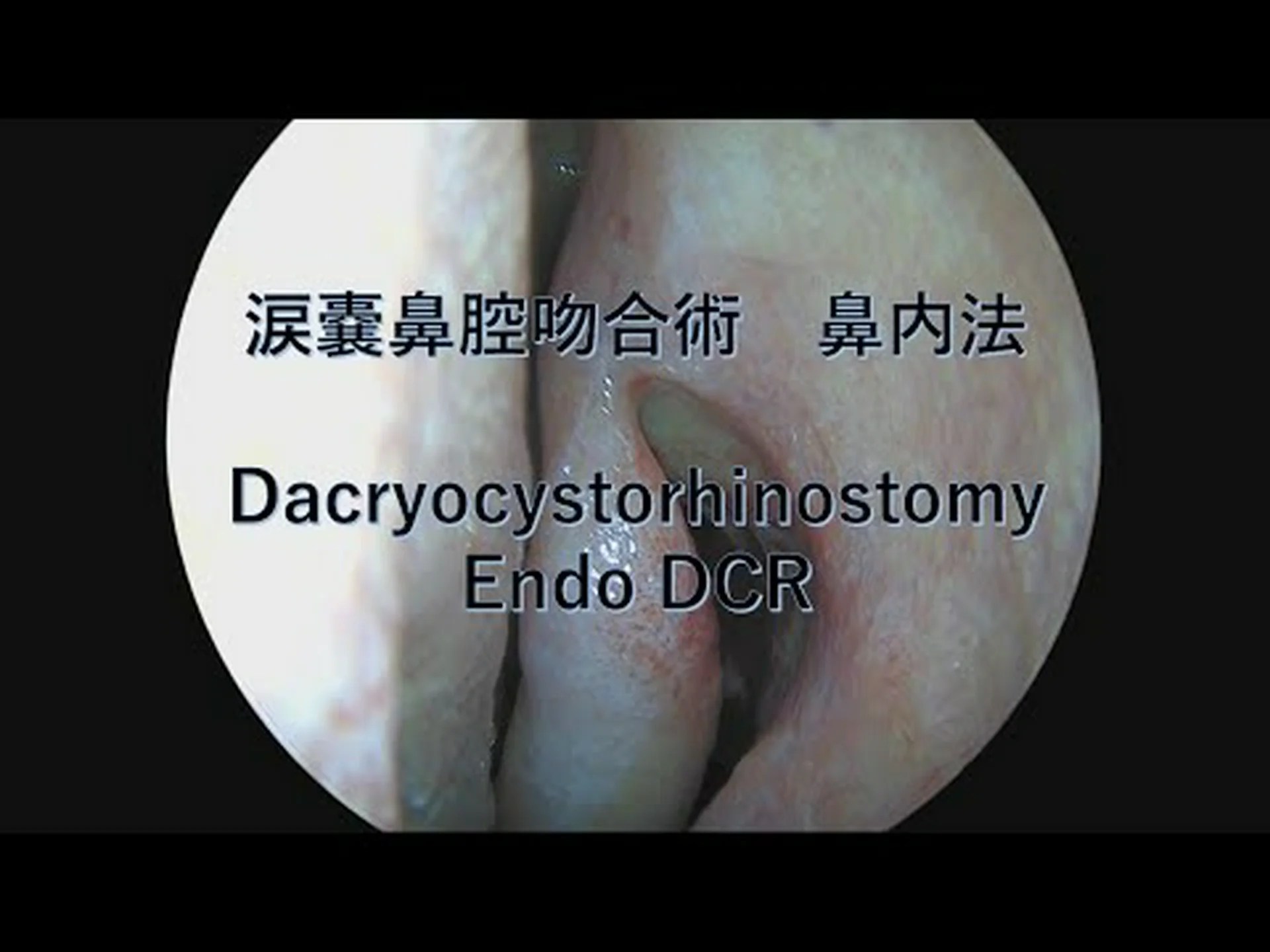 正しい道への鼻 正しい道への鼻