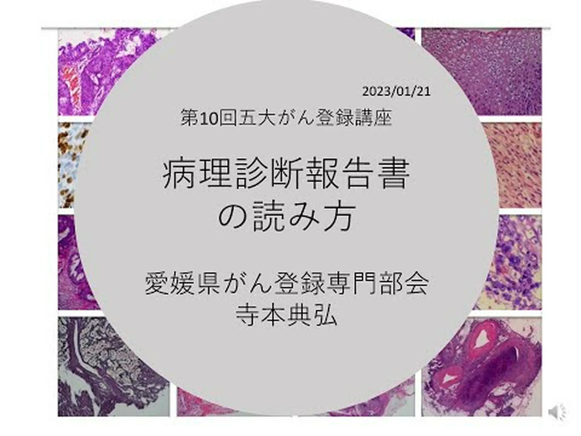 がん支援は報告義務を伴う全国的ながん登録を求めている がん支援は報告義務を伴う全国的ながん登録を求めている