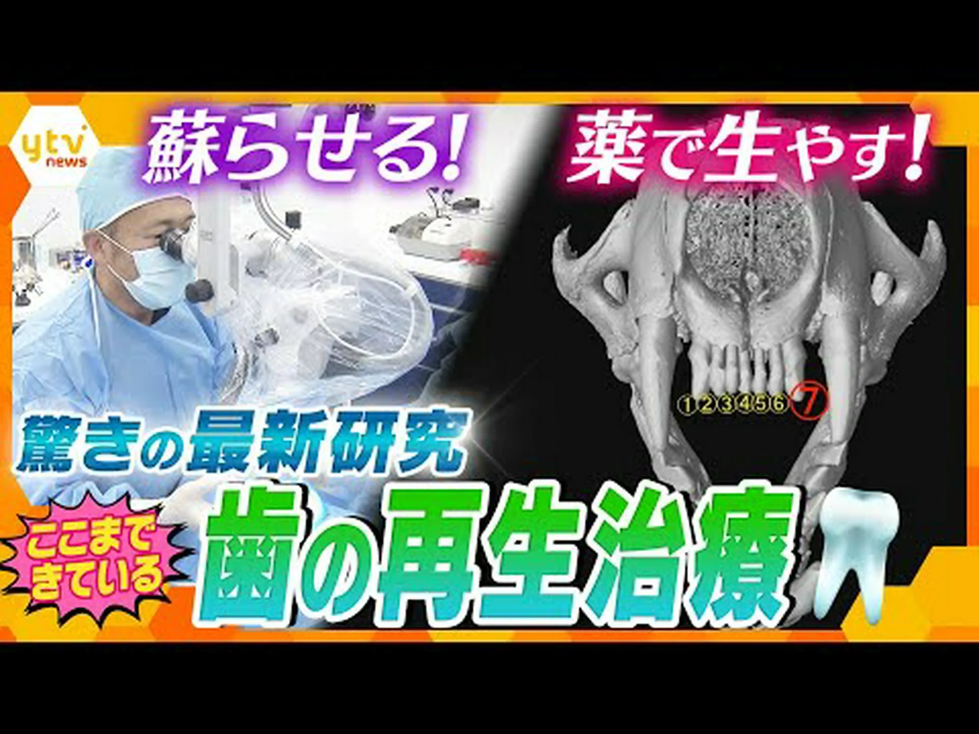 細菌が死ぬと歯が弱くなる 細菌が死ぬと歯が弱くなる