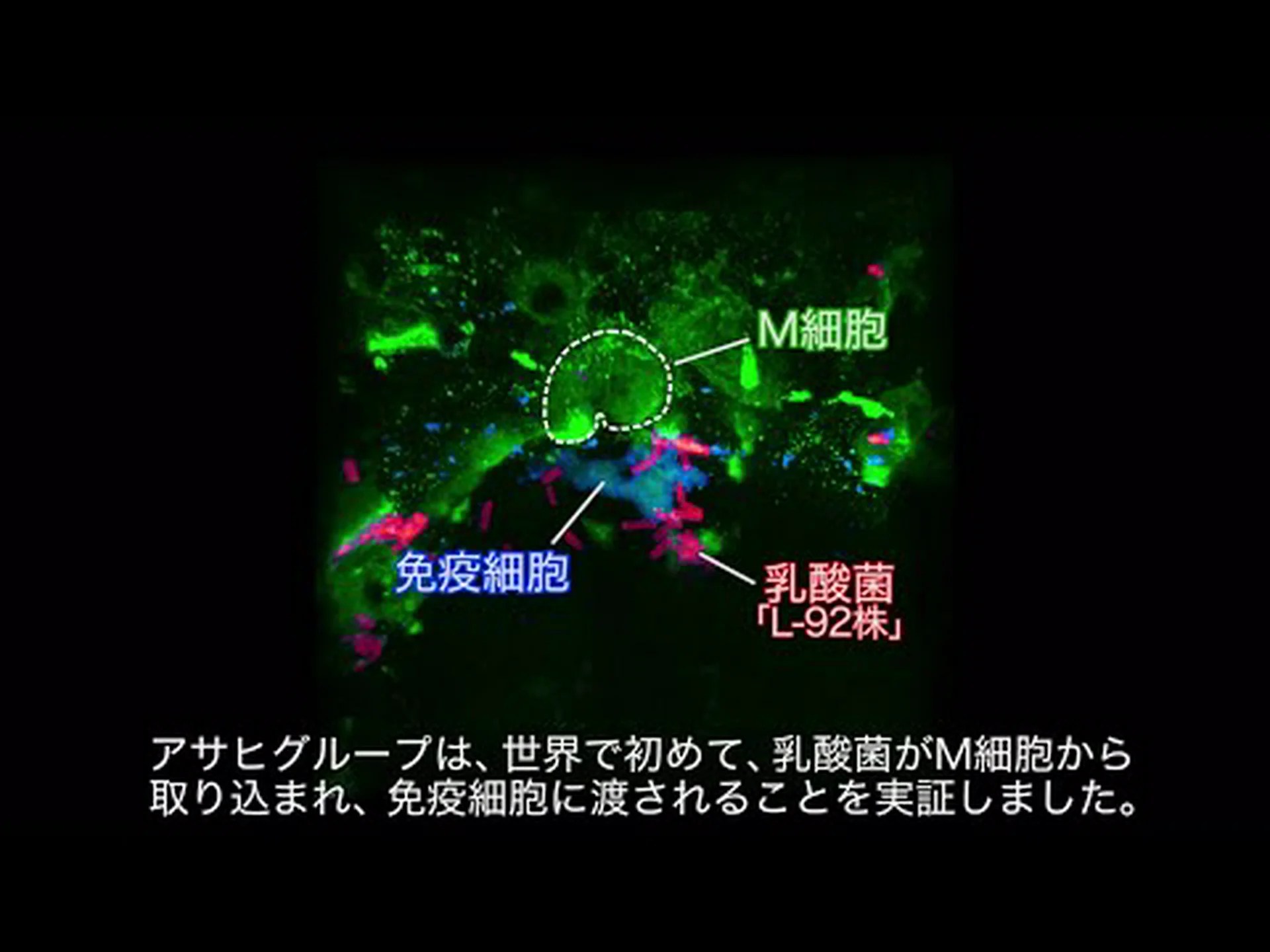 大腸菌は乳生成細胞を自殺に追いやる 大腸菌は乳生成細胞を自殺に追いやる