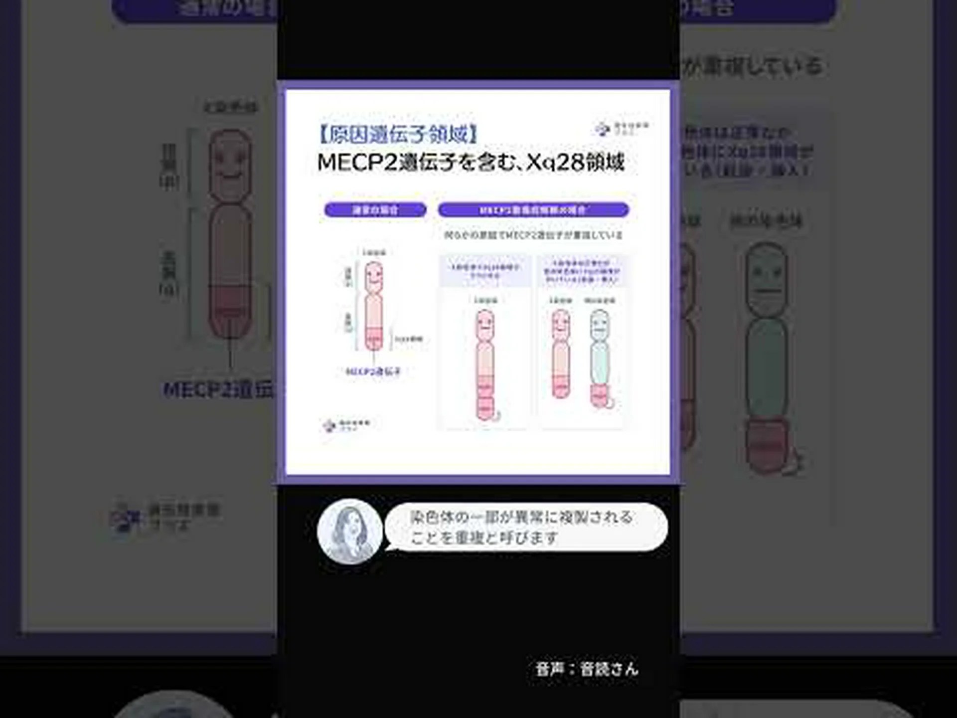 RNAが遺伝性疾患の原因として初めて特定される RNAが遺伝性疾患の原因として初めて特定される