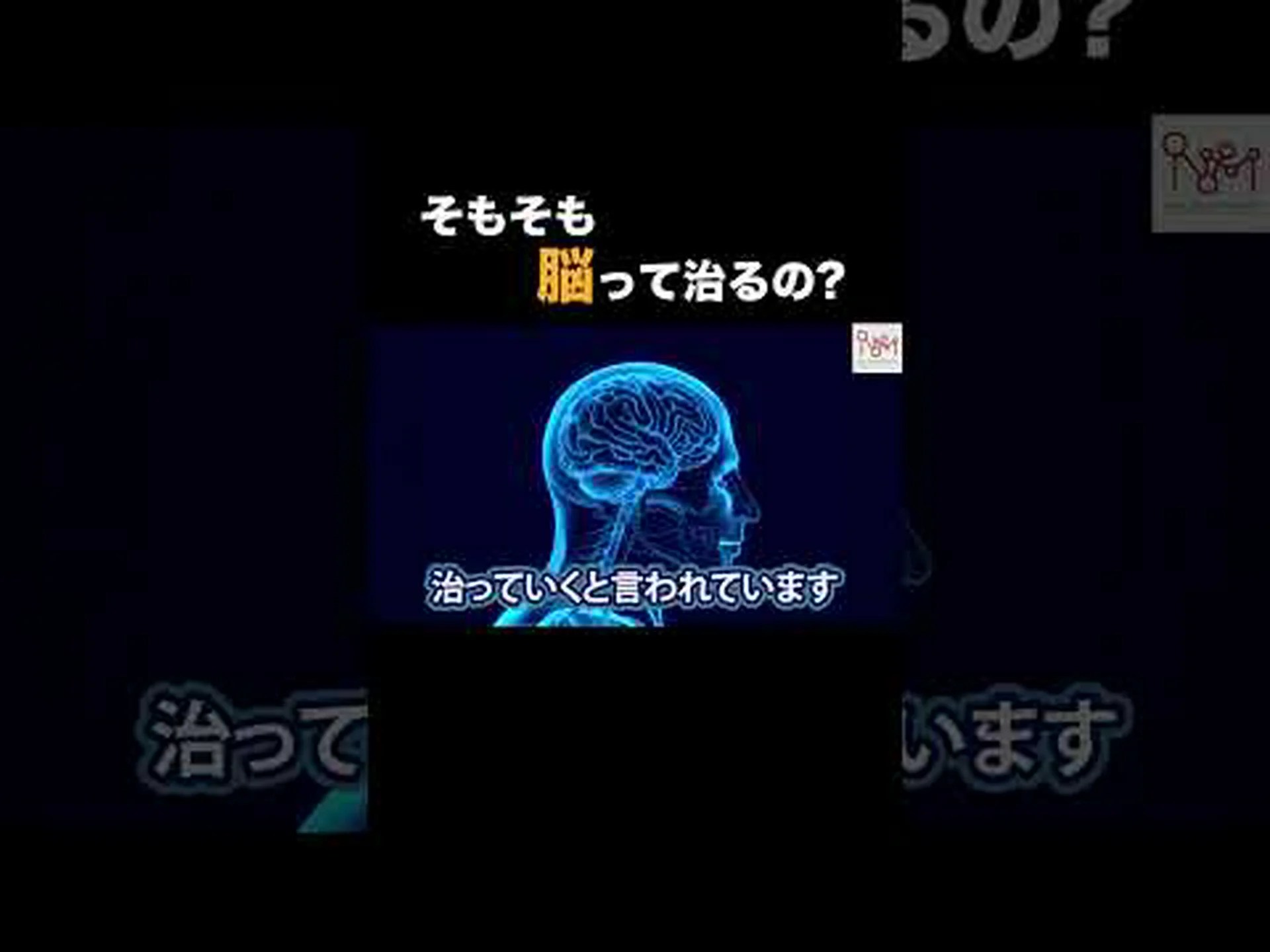 怪我後の脳の再生は予想以上に良好 怪我後の脳の再生は予想以上に良好