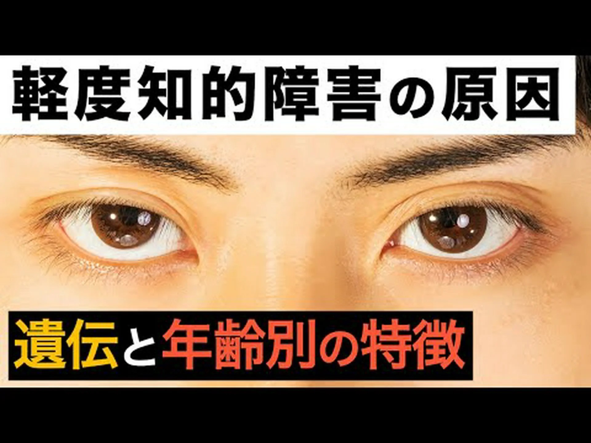 ヤギも知的障害を望んでいます ヤギも知的障害を望んでいます