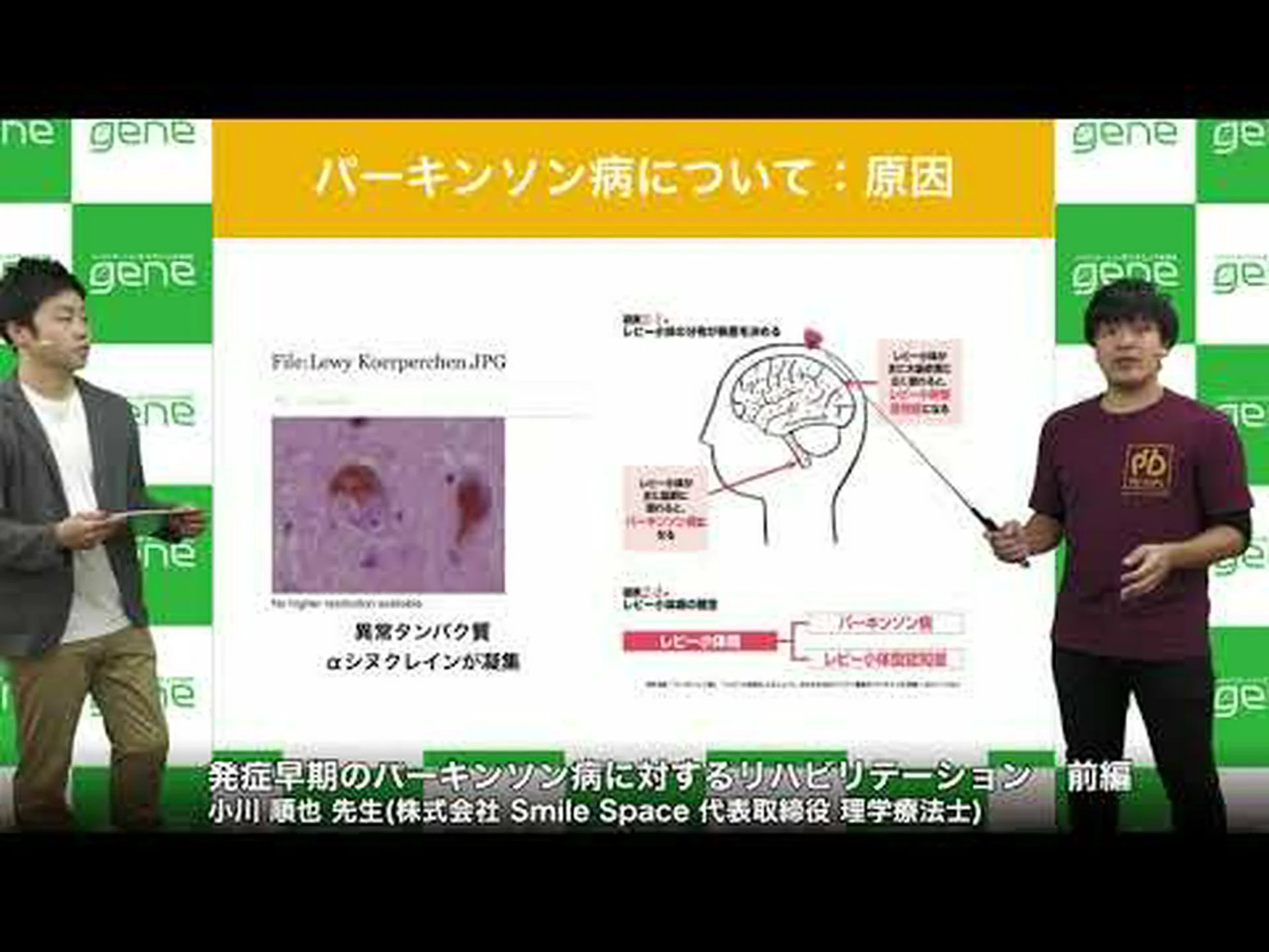 パーキンソン病に対する石膏 パーキンソン病に対する石膏